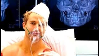 Sage Northcutt vs Cosmo Alexandre Facial bone fracture [upl. by Ettezzil]