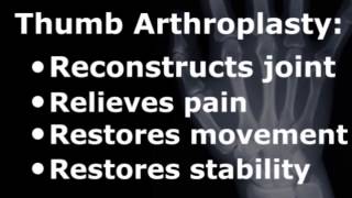 Thumb CMC Arthroplasty  Thumb Joint Reconstruction [upl. by Fannie]