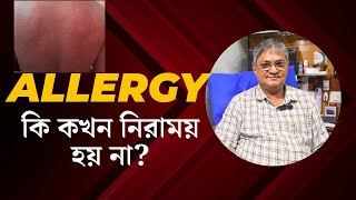 allergy কি কখনও Cure হয় না The FASTEST Way to Get Rid of Your allergic reaction  allergyর সমস্যা [upl. by Watters673]