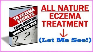 Eczema Treatment  How To Get Rid Of Eczema Naturally [upl. by Hsatan]