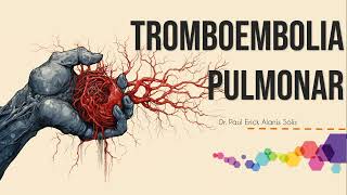 Tromboembolia Pulmonar [upl. by Poland3]