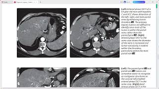 LIVER DIAGNOSTIC IMAGING SERIES [upl. by Ermine502]