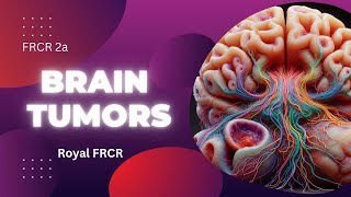 6  Neuroimaging for FRCR [upl. by Gerard]