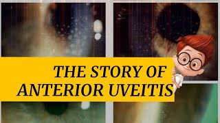 The story of ANTERIOR UVEITIS  iritis cyclitis and iridocyclitis  Signs amp symptoms and more [upl. by Arek376]