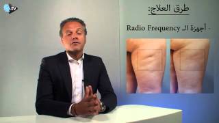 علاج للسلوليت بإستخدام تردد الراديو  Radio Frequency Cellulite Treatment  النهار  Dr Dany Touma [upl. by Eerrahs]