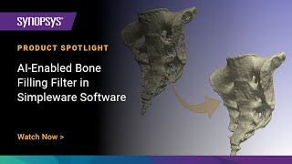 AIEnabled Bone Filling Filter in Simpleware Software [upl. by Ecyle]