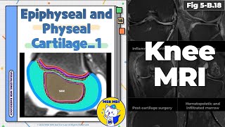 Fig 5B18 Normal Epiphyseal and Physeal Cartilage Part 1 [upl. by Ruhnke90]