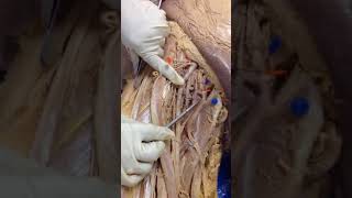 Femoral Artery and Branches dissection of cadaver human anatomy lab 1st MBBS [upl. by Carpio]