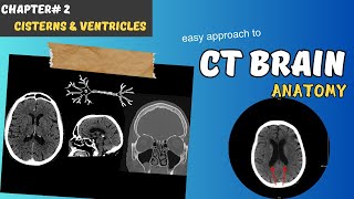 CT BRAIN Chapter 2 Cisterns amp Ventricles [upl. by Nomrac]