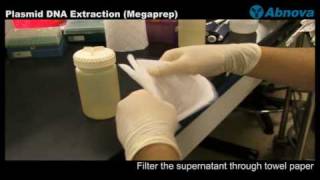 Plasmid DNA Extraction Megaprep [upl. by Arreip]