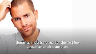 Do’s amp Don’ts After Hair Transplant [upl. by Fazeli]