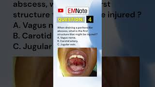 Draining Peritonsillar Abscess medical doctor nursing [upl. by Genet]