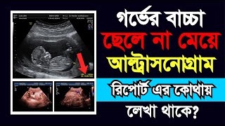 আল্ট্রাসনোগ্রাফি রিপোর্ট দেখে সহজে জেনে নিন গর্ভের সন্তান ছেলে না মেয়ে  ultrasonography report [upl. by Tselec]