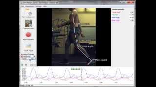 Gait Analysis protocol in Simi Aktisys [upl. by Ednalrim]