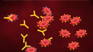 Type II Hypersensitivity Cytotoxic Type HD Animation [upl. by Griselda]