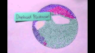 Xenopus Gastrulation Stop Animation [upl. by Gautier8]