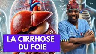 Tout ce que vous devez savoir sur La cirrhose du foie par docteursourire [upl. by Adnael]