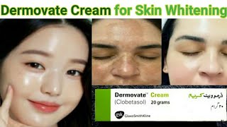 Dermovate Cream for Skin Whitening  dermovate cream ke Fayde  Dermovate cream Uses [upl. by Ainat]