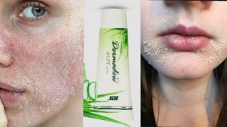 Dermadew Aloe Cream Review For Dry Skin  Dermadew aloe lotion ka fayde [upl. by Nazar]