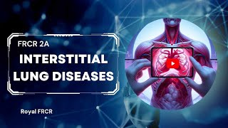 9  Chest Imaging for FRCR [upl. by Bick]