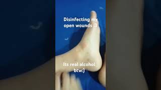 Disinfection disinfectant wounds shorts [upl. by Bryce]