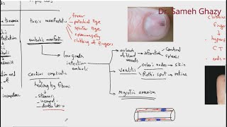 Systemic pathology 4  CVS infective and noninfective endocarditis DRSAMEH GHAZY [upl. by Llevol]