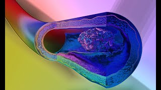 Galectin3 binds the Transferrin Receptor amp Kills TCells  Failed Biochemist Season 2020 ep 61 [upl. by Netsruk]