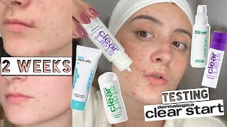 TESTING DERMALOGICA CLEAR START SKINCARE ON MY ACNE FOR 2 WEEKS [upl. by Enileve]