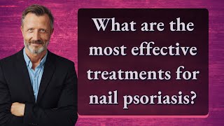 What are the most effective treatments for nail psoriasis [upl. by Reffineg231]