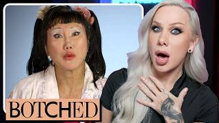 BOTCHED Can transracial plastic surgeries be reversed volume 1 [upl. by Moriarty]