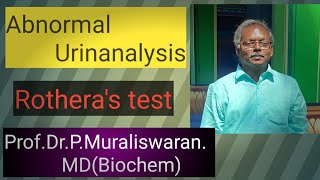 Rotheras test Muralis Simplified Biochemistry [upl. by Moriah]