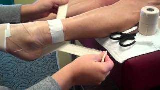 Taping for Achilles Tendinitis [upl. by Viquelia348]