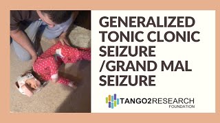 Generalized Tonic Clonic Seizure  Grand Mal Seizure [upl. by Nue]