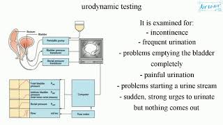 urodynamic testing [upl. by Center]