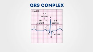 Mastering ECG  QRS complex by Dr Gireesh Kumar KP [upl. by Purse]