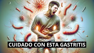 Gastritis Eritematosa Antral TRATAMIENTO 🔥 Síntomas y Causas de la Gastritis Eritematosa Antral [upl. by Clarabelle]