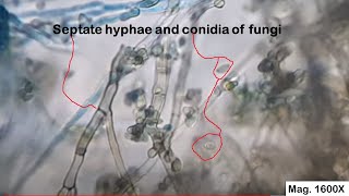 Septate hyphae and conidia of fungi [upl. by Yks]