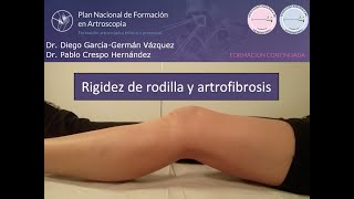 Rigidez de Rodilla y Artrofibrosis Artrolisis Artroscópica Artroscopia de Rodilla [upl. by Lunt]