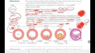 Arteriosclerosis 2  BACK BENCHERS ACADEMY [upl. by Aniakudo97]