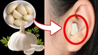 Put Garlic In Your Ear For 30 minutes And See what happens Next [upl. by Maril]