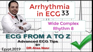 ECG from A to Z intermediate level Arrhythmia 33 Dr Alaa Nasr 201 [upl. by Naul511]