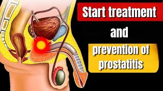 Effective Treatment and Prevention Tips for Prostatitis A Comprehensive Guidequot [upl. by Aruol]