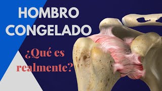 HOMBRO CONGELADO ¿Qué dice la CIENCIA Diagnóstico causas duración y tratamiento [upl. by Zoarah]