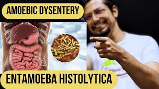 Amoebic dysentery  entamoeba histolytica  Cause diagnosis pathogenesis and treatment [upl. by Caz933]