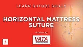 Horizontal Mattress Suture  Learn Suture Techniques  VATA [upl. by Leziar]