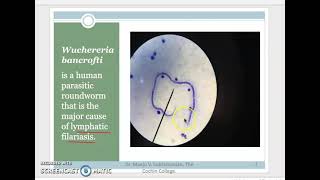 3 Phylum Nematoda Part 3 Classification [upl. by Inoy]