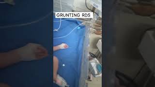 grunting rds neonate babygrunt ytviral shortsfeed nursingofficer hospitallife grunt nurses [upl. by Nauqal]