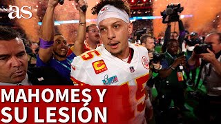 SUPER BOWL  MAHOMES consiguió el anillo LESIONADO  DIARIO AS [upl. by Eirac]