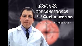 LESIONES EN CUELLO UTERINO POR QUE NO PAPANICOLAOU [upl. by Mihe]