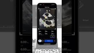 mobile Echocardiography AI solution [upl. by Civ]